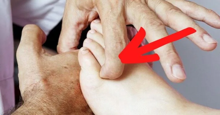 Nervo Sciatico Cura – 12 Rimedi Naturali Da Usare Subito Per Il Dolore